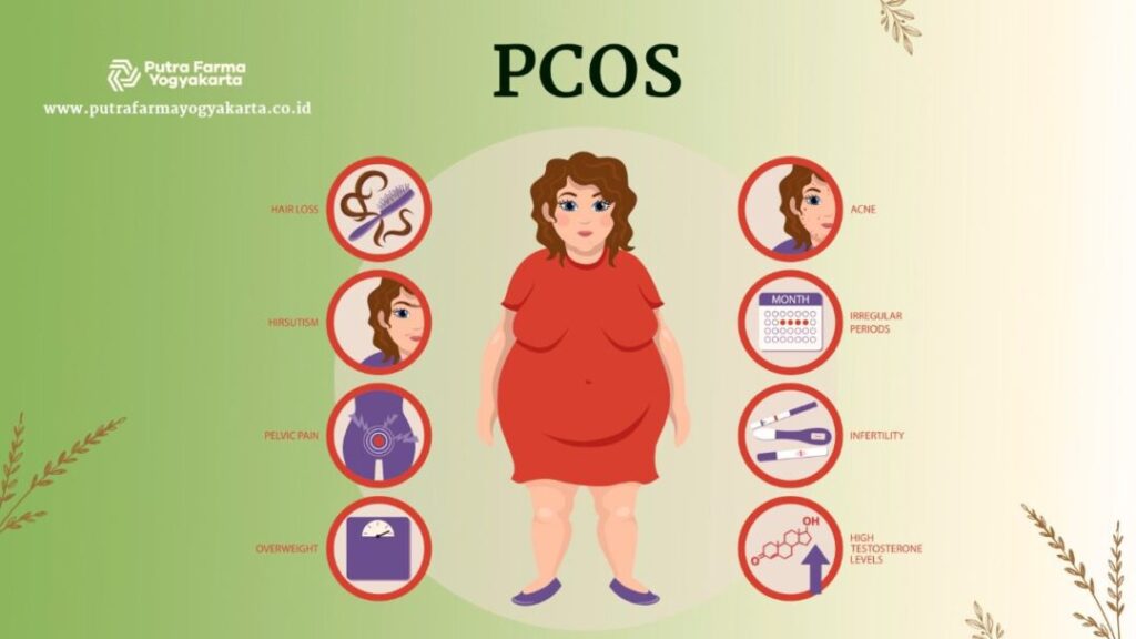 gangguan ovarium PCOS Kenali 9 Tanda Gangguan Ovarium PCOS Yuk Ladies!