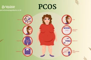Kenali 9 Tanda Gangguan Ovarium PCOS Yuk Ladies!
