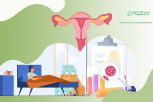 Ketahui 3 Penyebab Kista Bartholin yang Menyerang Vagina