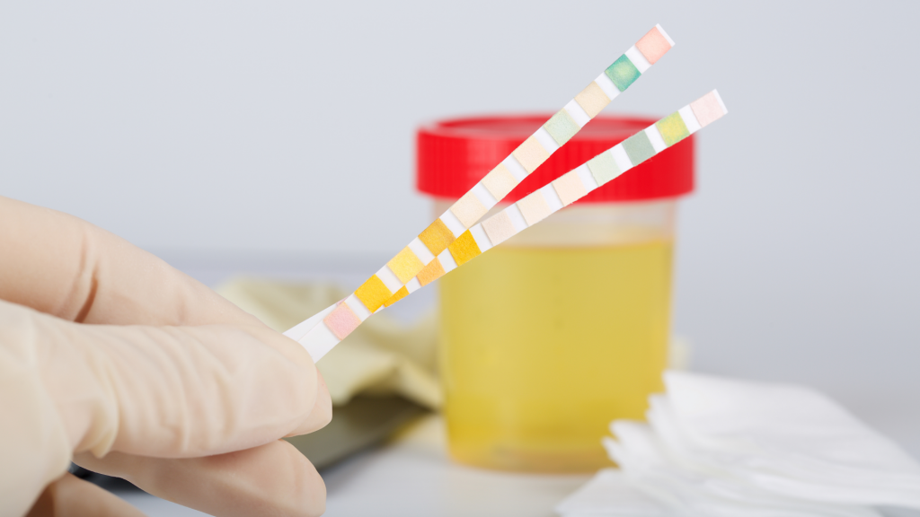 candidiasis