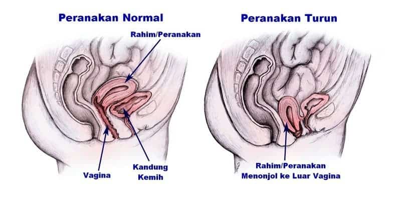 senam kegel