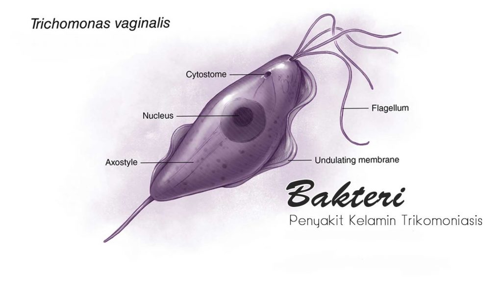 trikomoniasis