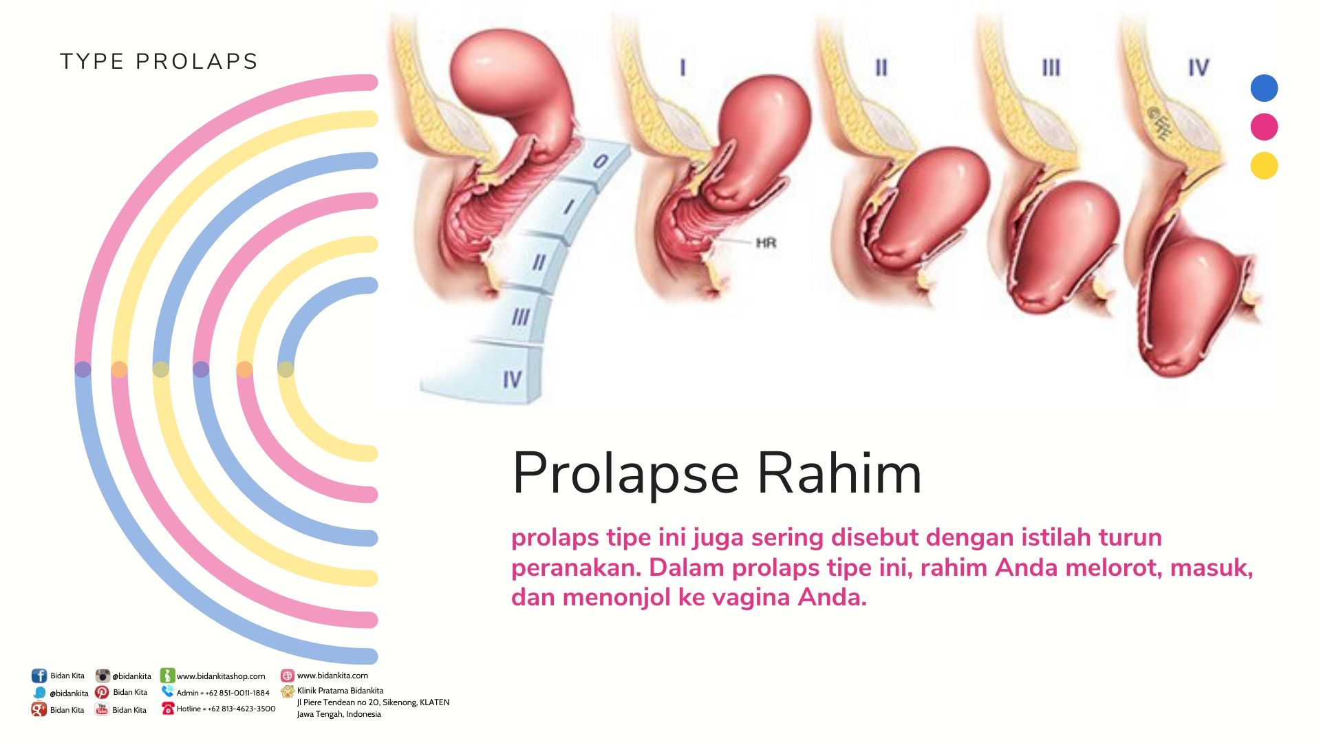 16 Penyebab Rahim Turun, Cek Ulasannya Di Sini 3 rahim turun