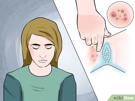 tanda kutil vagina