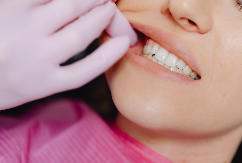 keajaiban jus jambu biji keajaiban jus jambu biji