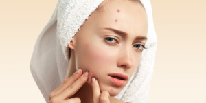 collagen drinks for acne