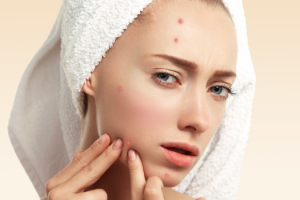 collagen drinks for acne