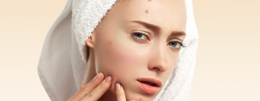 collagen drinks for acne