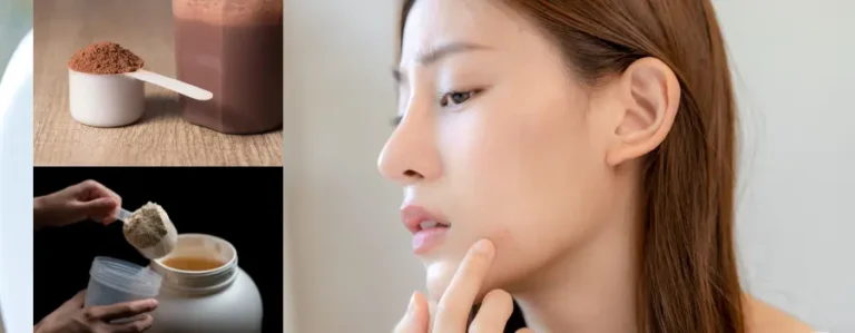 whey protein can cause acne?